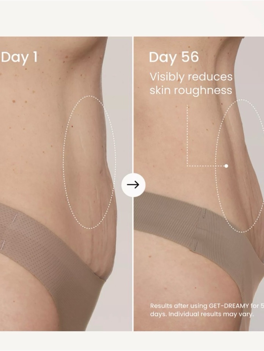 GET-DREAMY Overnight Toning Body Whip- New - Picture 7 of 11
